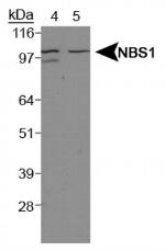 NBS1 Antibody in Western Blot (WB)