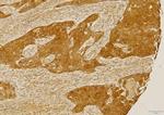 CCR2 Antibody in Immunohistochemistry (Paraffin) (IHC (P))