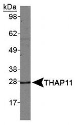 THAP11 Antibody in Western Blot (WB)