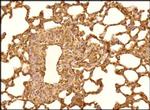 PTCH Antibody in Immunohistochemistry (Paraffin) (IHC (P))