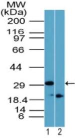 Rhox11 Antibody in Western Blot (WB)