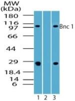 BNC1 Antibody in Western Blot (WB)