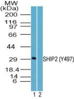 Phospho-SHIP2 (Tyr497) Antibody in Western Blot (WB)