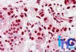 hnRNP K Antibody in Immunohistochemistry (Paraffin) (IHC (P))