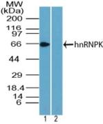 hnRNP K Antibody in Western Blot (WB)