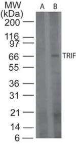 TRIF Antibody in Western Blot (WB)