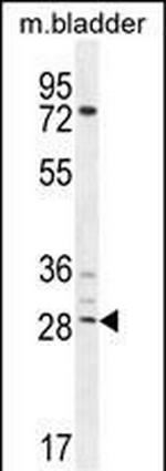 AKIP1 Antibody in Western Blot (WB)