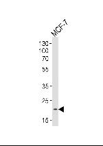 NOS1AP Antibody in Western Blot (WB)