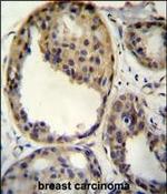 AKT1 Antibody in Immunohistochemistry (Paraffin) (IHC (P))