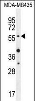 AKT1 Antibody in Western Blot (WB)