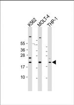 IBA1 Antibody in Western Blot (WB)