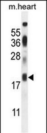 ISCA2 Antibody in Western Blot (WB)