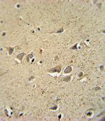 SCN1B Antibody in Immunohistochemistry (Paraffin) (IHC (P))