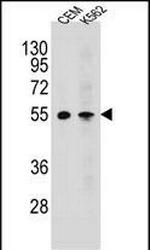 MCHR1 Antibody in Western Blot (WB)