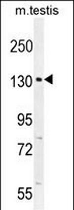 CIC Antibody in Western Blot (WB)