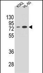 ENTPD3 Antibody in Western Blot (WB)