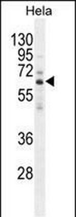 HYAL2 Antibody in Western Blot (WB)