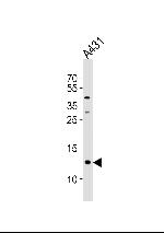 SPRR2A Antibody in Western Blot (WB)