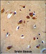 PLEKHG1 Antibody in Immunohistochemistry (Paraffin) (IHC (P))