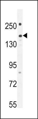 PLEKHG1 Antibody in Western Blot (WB)