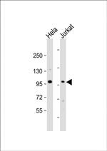 NSUN2 Antibody in Western Blot (WB)