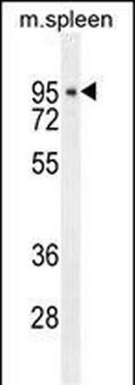 DTL Antibody in Western Blot (WB)