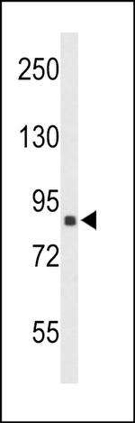 TNPO1 Antibody in Western Blot (WB)