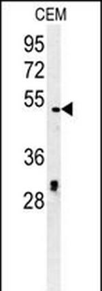 DSCC1 Antibody in Western Blot (WB)