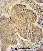 PSMD7 Antibody in Immunohistochemistry (Paraffin) (IHC (P))