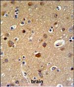 TELO2 Antibody in Immunohistochemistry (Paraffin) (IHC (P))