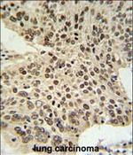 HIST1H2AG Antibody in Immunohistochemistry (Paraffin) (IHC (P))