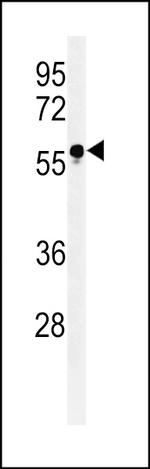 FUT6 Antibody in Western Blot (WB)