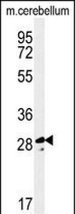 TESC Antibody in Western Blot (WB)