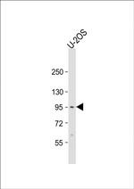 EPC2 Antibody in Western Blot (WB)