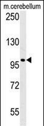 EPC2 Antibody in Western Blot (WB)