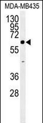 ERO1LB Antibody in Western Blot (WB)