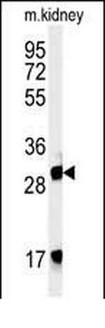 FBXL15 Antibody in Western Blot (WB)