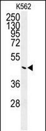 G6PC Antibody in Western Blot (WB)