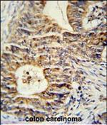 KLHL24 Antibody in Immunohistochemistry (Paraffin) (IHC (P))