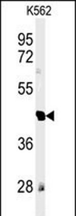 RTN4RL1 Antibody in Western Blot (WB)