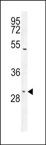 SLC25A1 Antibody in Western Blot (WB)