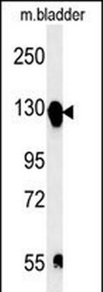 ITGA5 Antibody in Western Blot (WB)