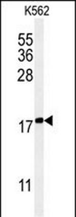 KRTAP1-1 Antibody in Western Blot (WB)