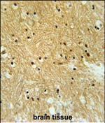 Importin 9 Antibody in Immunohistochemistry (Paraffin) (IHC (P))