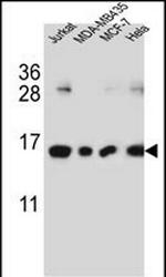 H2AFJ Antibody in Western Blot (WB)