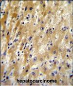 HABP2 Antibody in Immunohistochemistry (Paraffin) (IHC (P))