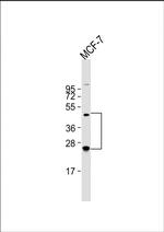 HABP2 Antibody in Western Blot (WB)