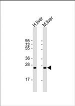 HABP2 Antibody in Western Blot (WB)