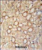 CRB2 Antibody in Immunohistochemistry (Paraffin) (IHC (P))