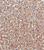 HSD17B13 Antibody in Immunohistochemistry (Paraffin) (IHC (P))